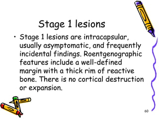 Stage 1 lesionsStage 1 lesions are intracapsular, usually asymptomatic, and frequently incidental findings. Roentgenographic features include a well-defined margin with a thick rim of reactive bone. There is no cortical destruction or expansion. 60