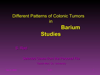 Jun 8, 2009 S. R. Different Patterns of Colonic Tumors  in  Barium Studies S. Rad   Selected Cases from the Personal File Tabriz Med. Sc. University 