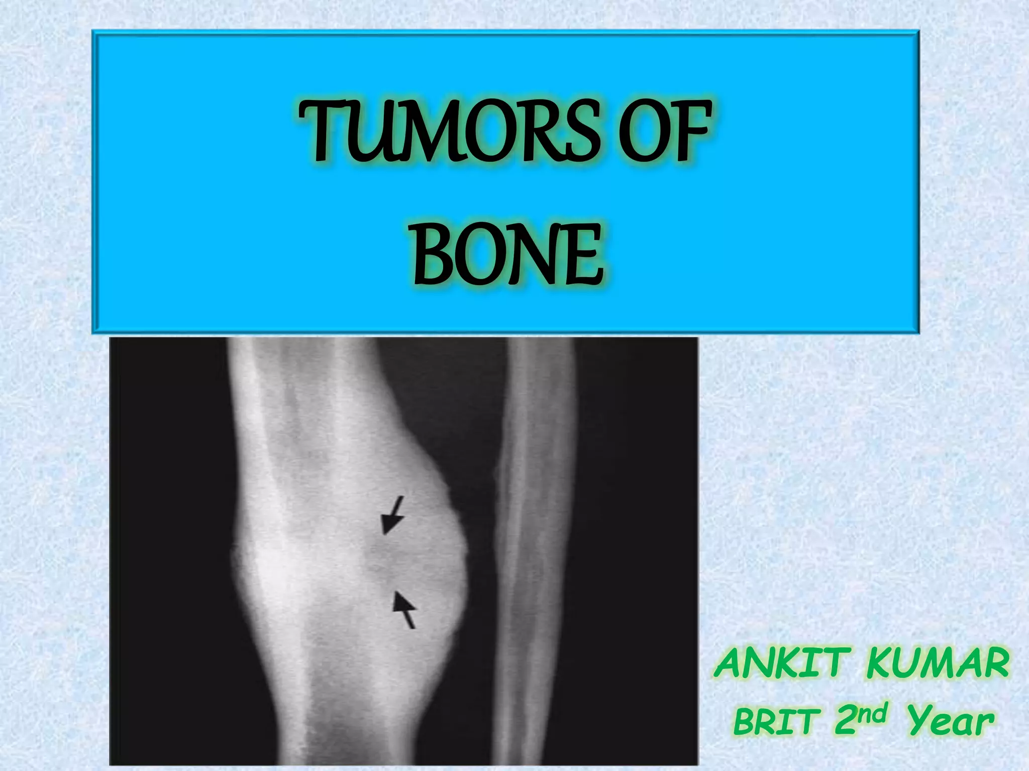Tumors of bone | PPTX