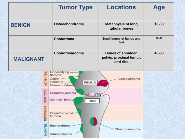 Tumors of bone | PPTX