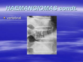 TUMORS OF BONE AND JOINTS IN ORTHOPAEDICS (4).ppt