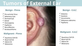 Red Mass In Ear Comprehensive Overview of Ear Tumors: Diagnosis and Treatment | PPTX