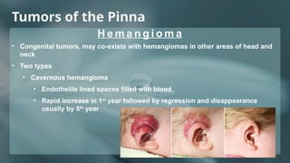 Red Mass In Ear Comprehensive Overview of Ear Tumors: Diagnosis and Treatment | PPTX
