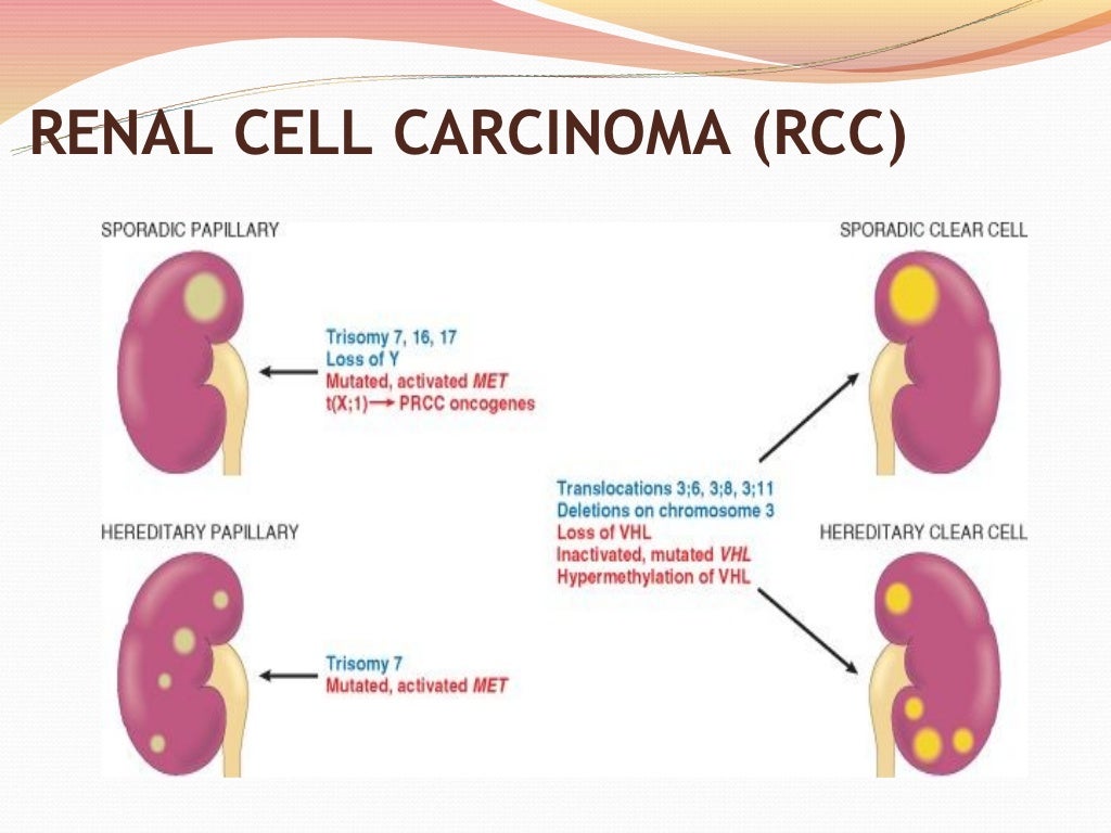 Tumors of kidney & urinary tract 2012
