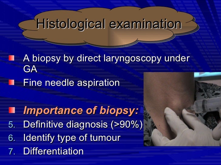 E.N.T,Tumors of larynx.(dr.usif chalabe)