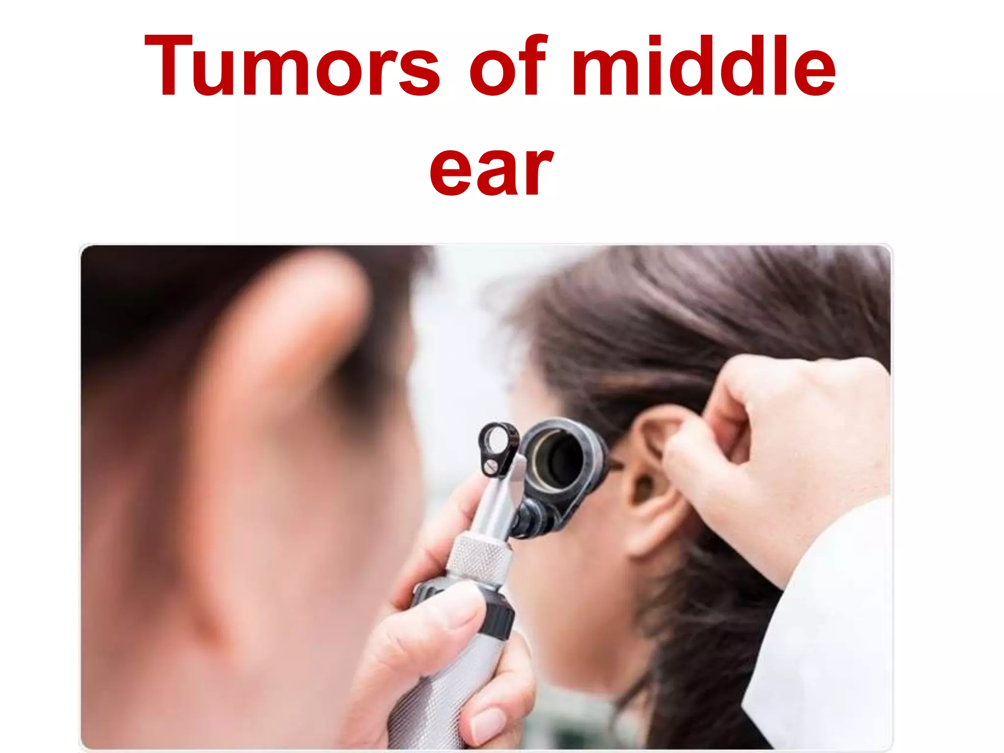 Tumors of middle ear.pptx