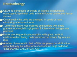 Tumors of odontogenic origin | PPTX