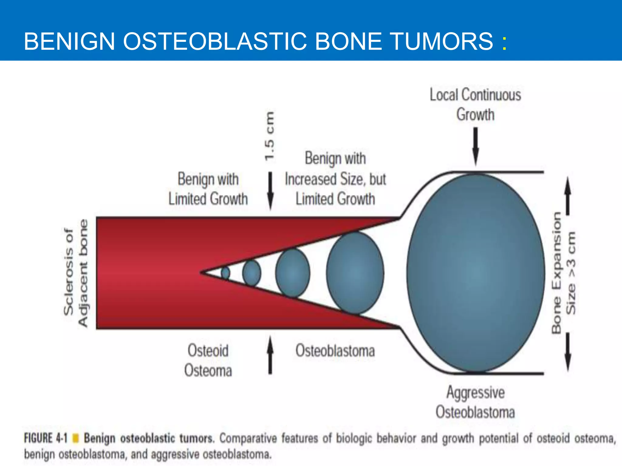 BENIGN OSTEOBLASTIC BONE TUMORS :
 