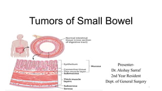 Tumors of Small Bowel
Presenter-
Dr. Akshay Sarraf
2nd Year Resident
Dept. of General Surgery
1
 