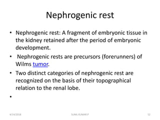 Tumors of the kidney | PPTX