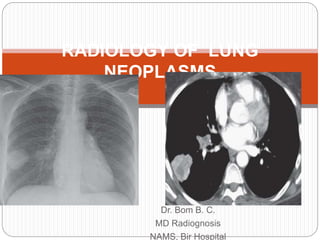 Dr. Bom B. C.
MD Radiognosis
NAMS, Bir Hospital
RADIOLOGY OF LUNG
NEOPLASMS
 
