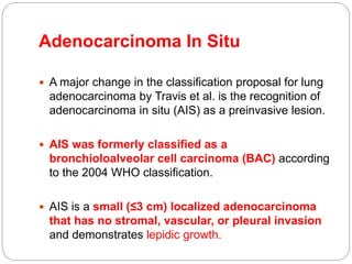 Radiology of lung neoplasms | PPTX