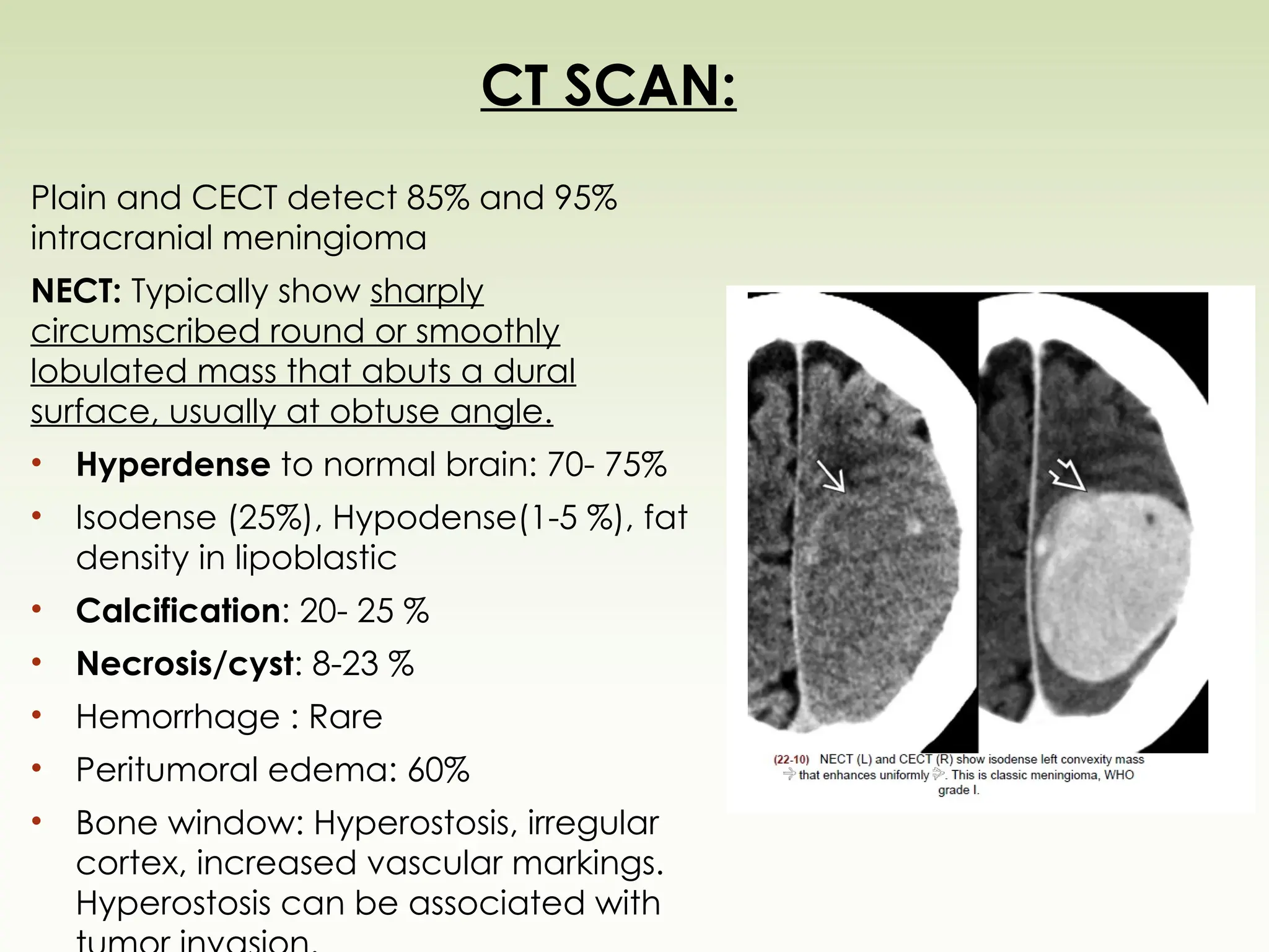 CT SCAN:
Plain and CECT detect 85% and 95%
intracranial meningioma
NECT: Typically show sharply
circumscribed round or smoothly
lobulated mass that abuts a dural
surface, usually at obtuse angle.
• Hyperdense to normal brain: 70- 75%
• Isodense (25%), Hypodense(1-5 %), fat
density in lipoblastic
• Calcification: 20- 25 %
• Necrosis/cyst: 8-23 %
• Hemorrhage : Rare
• Peritumoral edema: 60%
• Bone window: Hyperostosis, irregular
cortex, increased vascular markings.
Hyperostosis can be associated with
 