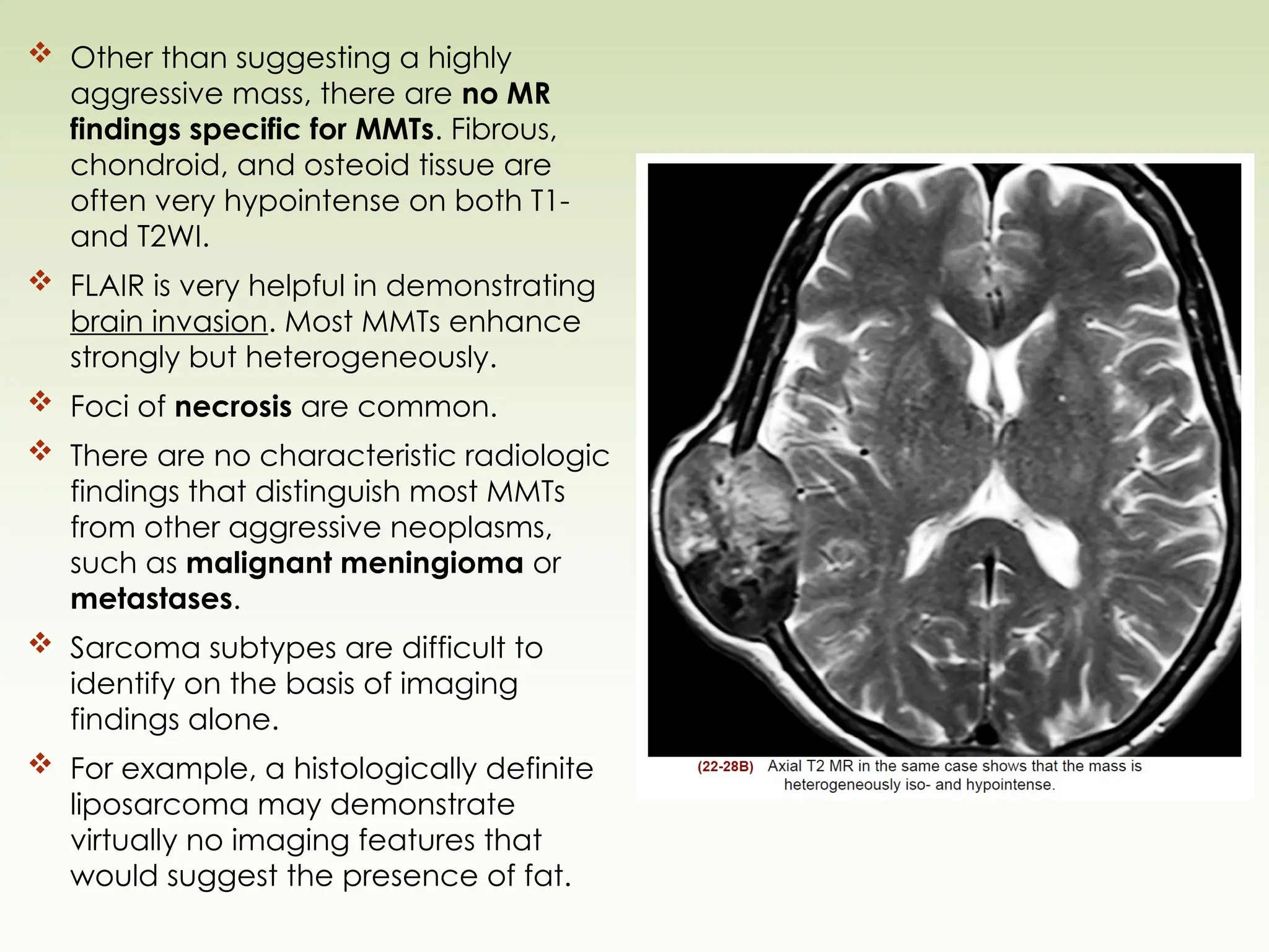  Other than suggesting a highly
aggressive mass, there are no MR
findings specific for MMTs. Fibrous,
chondroid, and osteoid tissue are
often very hypointense on both T1-
and T2WI.
 FLAIR is very helpful in demonstrating
brain invasion. Most MMTs enhance
strongly but heterogeneously.
 Foci of necrosis are common.
 There are no characteristic radiologic
findings that distinguish most MMTs
from other aggressive neoplasms,
such as malignant meningioma or
metastases.
 Sarcoma subtypes are difficult to
identify on the basis of imaging
findings alone.
 For example, a histologically definite
liposarcoma may demonstrate
virtually no imaging features that
would suggest the presence of fat.
 