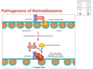 Pathogenesis of Retinoblastoma
 