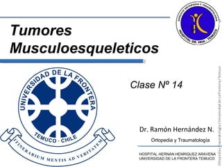 Dr. Ramón Hernández N. HOSPITAL HERNAN HENRIQUEZ ARAVENA UNIVERSIDAD DE LA FRONTERA TEMUCO Ortopedia y Traumatología Clase Nº 14 Tumores Musculoesqueleticos 