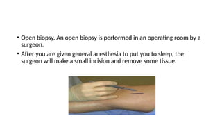 • Open biopsy. An open biopsy is performed in an operating room by a
surgeon.
• After you are given general anesthesia to put you to sleep, the
surgeon will make a small incision and remove some tissue.
 