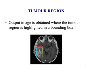 TUMOUR REGION
• Output image is obtained where the tumour
region is highlighted in a bounding box.
11
 