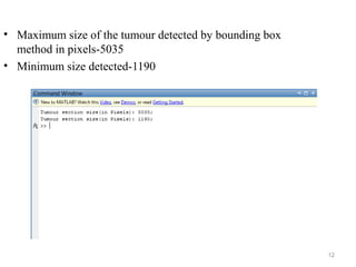 12
• Maximum size of the tumour detected by bounding box
method in pixels-5035
• Minimum size detected-1190
 