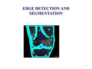 EDGE DETECTION AND
SEGMENTATION
14
 