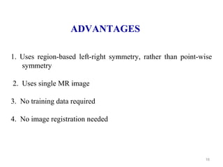 16
ADVANTAGES
1. Uses region-based left-right symmetry, rather than point-wise
symmetry
2. Uses single MR image
3. No training data required
4. No image registration needed
 