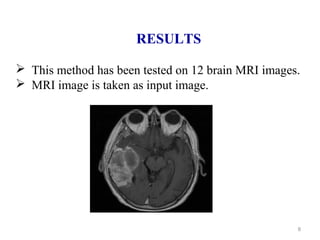 8
RESULTS
 This method has been tested on 12 brain MRI images.
 MRI image is taken as input image.
 