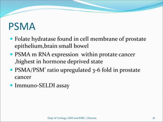 PSMA
 Folate hydratase found in cell membrane of prostate
epithelium,brain small bowel
 PSMA m RNA expression within protate cancer
,highest in hormone deprived state
 PSMA/PSM’ ratio upregulated 3-6 fold in prostate
cancer
 Immuno-SELDI assay
18
Dept of Urology, GRH and KMC, Chennai.
 