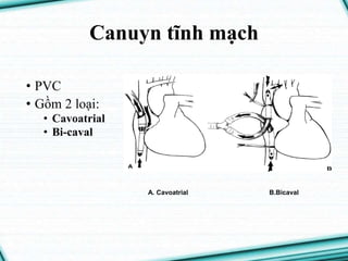 Caval Pvc TUẦN-HOÀN-NGOÀI-CƠ-THỂ.pptx