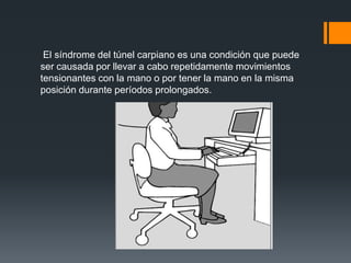 El síndrome del túnel carpiano es una condición que puede
ser causada por llevar a cabo repetidamente movimientos
tensionantes con la mano o por tener la mano en la misma
posición durante períodos prolongados.
 