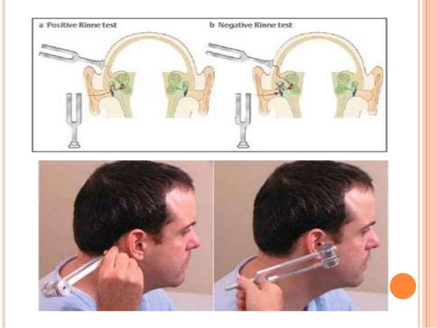 physics behind tuning fork test physics behind tuning fork test