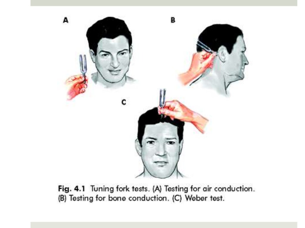 Tuning fork tests