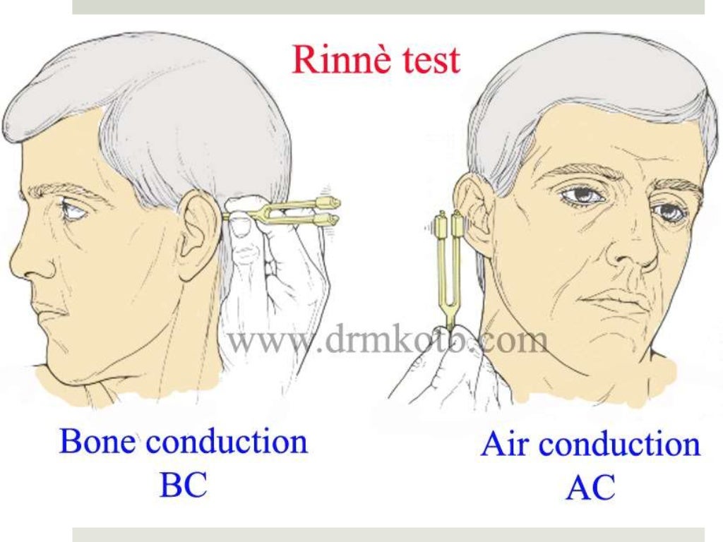 Tuning fork tests