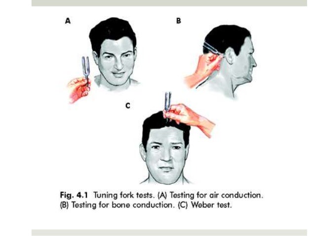 physics behind tuning fork test physics behind tuning fork test