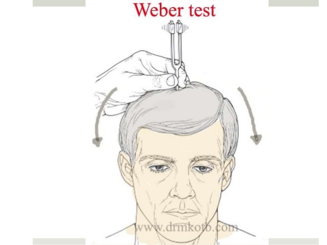 weber tuning fork test weber tuning fork test