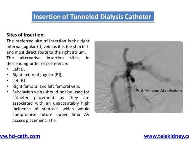 Tunneled catheter insertion
