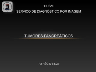 HUSM
SERVIÇO DE DIAGNÓSTICO POR IMAGEM




    TUMORES PANCREÁTICOS




           R2 RÉGIS SILVA
 