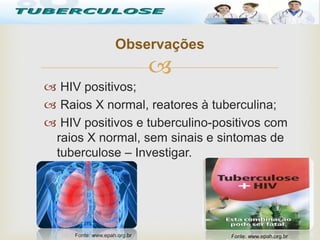 
 HIV positivos;
 Raios X normal, reatores à tuberculina;
 HIV positivos e tuberculino-positivos com
raios X normal, sem sinais e sintomas de
tuberculose – Investigar.
Observações
Tuberculose
Fonte: www.epah.org.brFonte: www.epah.org.br
 