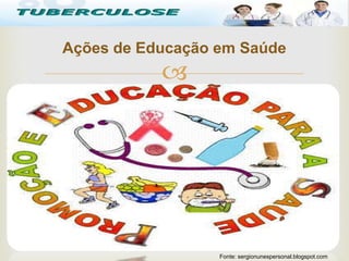 

Ações de Educação em Saúde
Tuberculose
Fonte: sergionunespersonal.blogspot.com
 