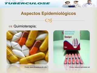 
 Quimioterapia;
Aspectos Epidemiológicos
Fonte: www.dicasdesaude.info Fonte: www.jornalcidade.net
 