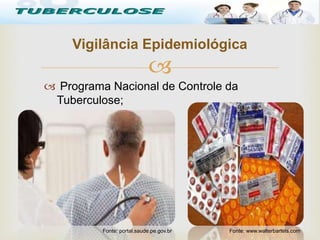 
 Programa Nacional de Controle da
Tuberculose;
Vigilância Epidemiológica
Tuberculose
Fonte: www.walterbartels.comFonte: portal.saude.pe.gov.br
 