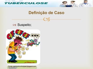 
 Suspeito;
Definição de Caso
Tuberculose
Fonte: opiniaotriunfodigital.blogspot.com
 