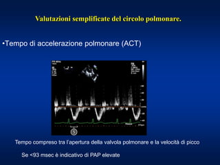 •Tempo di accelerazione polmonare (ACT)
Tempo compreso tra l’apertura della valvola polmonare e la velocità di picco
Se <93 msec è indicativo di PAP elevate
Valutazioni semplificate del circolo polmonare.
 