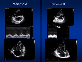 Paziente A Paziente B
 