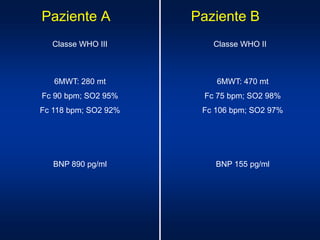 Paziente A Paziente B
Classe WHO III Classe WHO II
6MWT: 470 mt
Fc 75 bpm; SO2 98%
Fc 106 bpm; SO2 97%
6MWT: 280 mt
Fc 90 bpm; SO2 95%
Fc 118 bpm; SO2 92%
BNP 890 pg/ml BNP 155 pg/ml
 
