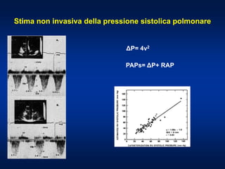Stima non invasiva della pressione sistolica polmonare
ΔP= 4v2
PAPs= ΔP+ RAP
 