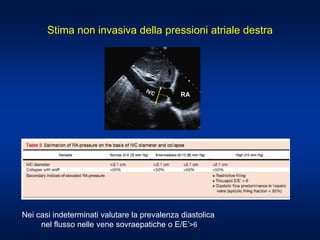 Stima non invasiva della pressioni atriale destra
Nei casi indeterminati valutare la prevalenza diastolica
nel flusso nelle vene sovraepatiche o E/E’>6
 