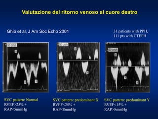 Ghio et al, J Am Soc Echo 2001
SVC pattern: Normal
RVEF>25% +
RAP<5mmHg
SVC pattern: predominant X
RVEF<25% +
RAP<8mmHg
SVC pattern: predominant Y
RVEF<15% +
RAP>8mmHg
31 patients with PPH,
111 pts with CTEPH
Valutazione del ritorno venoso al cuore destro
 