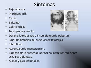 Síntomas
• Baja estatura.
• Pterigium colli.
• Ptosis.
• Epicanto.
• Cubito valgo.
• Tórax plano y amplio.
• Desarrollo retrasado o incompleto de la pubertad.
• Baja implantación del cabello y de las orejas.
• Infertilidad.
• Ausencia de la menstruación.
• Carencia de la humedad normal en la vagina; relaciones
  sexuales dolorosas.
• Manos y pies inflamados.
 