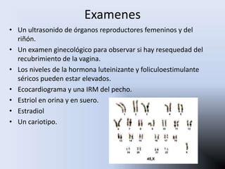 Examenes
• Un ultrasonido de órganos reproductores femeninos y del
  riñón.
• Un examen ginecológico para observar si hay resequedad del
  recubrimiento de la vagina.
• Los niveles de la hormona luteinizante y foliculoestimulante
  séricos pueden estar elevados.
• Ecocardiograma y una IRM del pecho.
• Estriol en orina y en suero.
• Estradiol
• Un cariotipo.
 