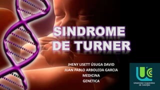 JHENY LISETT ÚSUGA DAVID
JUAN PABLO ARBOLEDA GARCIA
MEDICINA
GENETICA
SINDROME
DE TURNER
1
 